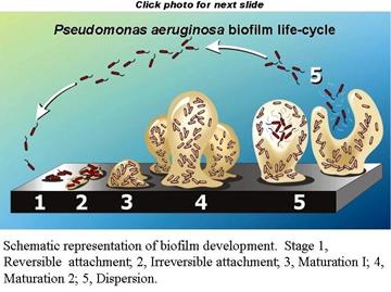 Pseudomonas aeruginosa biofilm life-cycle