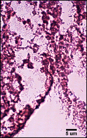 Light Micrograph of Gram-stained tissue