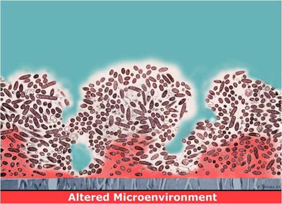 Biofilm Tolerance of Antimicrobial Agents