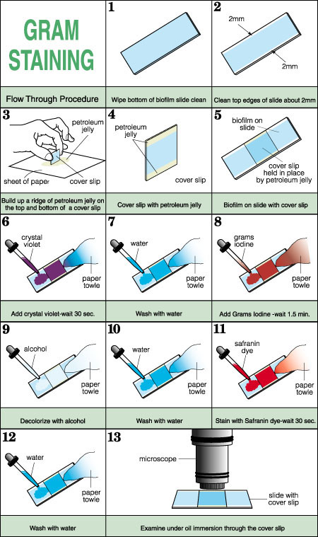 Gram staining method.