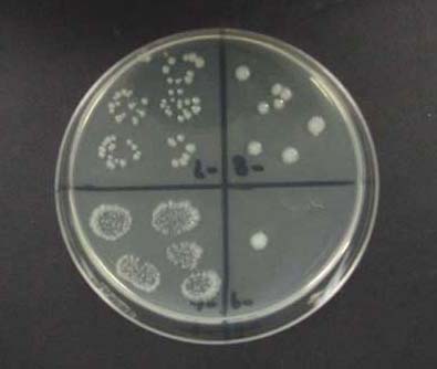 Figure 3. Example of a colonized agar plate