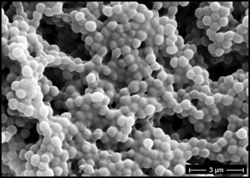 Scanning Electron micrograph of Staphylococcus aureus biofilm 